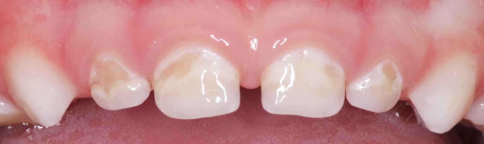 Детская стоматология и ортодонтия в Киеве - блог доктора Пешко Татьяны ...