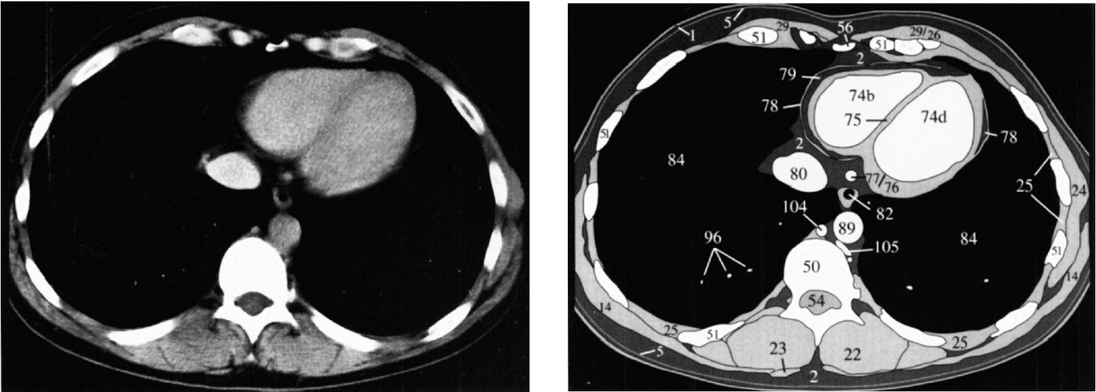 кт грудной клетки в нижнем новгороде