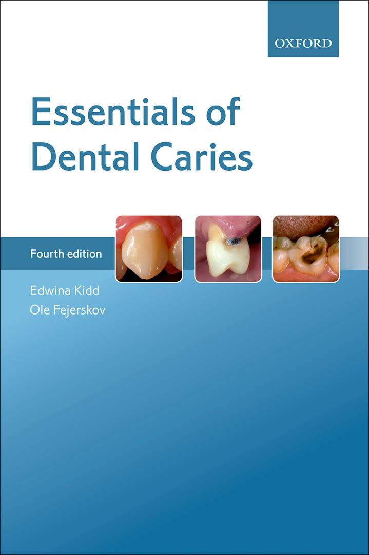 Essentials of Dental Caries 4th Edition Dental Pro