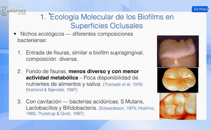 VIDEOCONFERENCIA: La Superficie Oclusal; Entendimiento Biológico y Manejo - Dr. José Luis Ureña