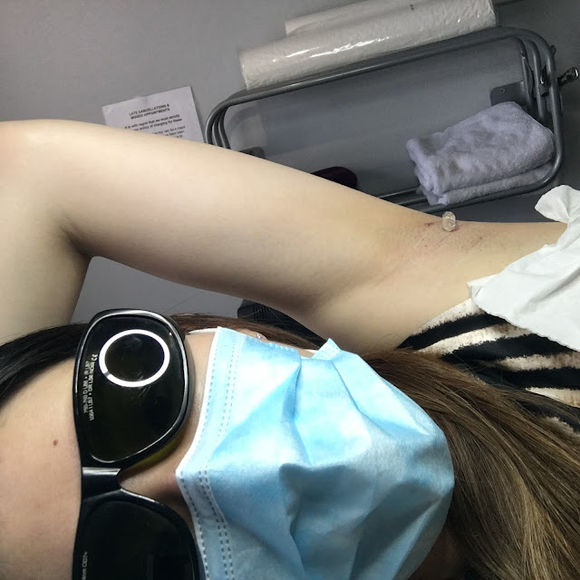 laser hair removal Oxford,Oxfordshire laser hair removal,bare UK Oxford review,bare UK Oxford reviews,bare UK prices,permanent hair removal Oxford,
