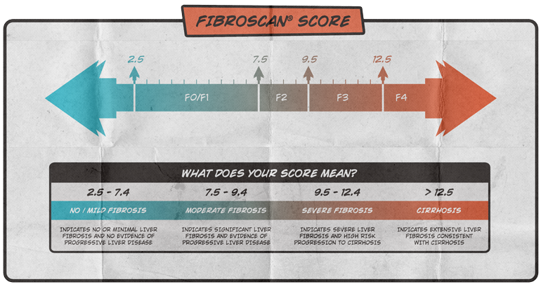 liver meld score