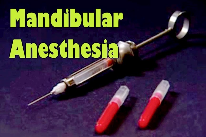 DENTAL ANESTHESIA Inferior alveolar nerve block Introduction