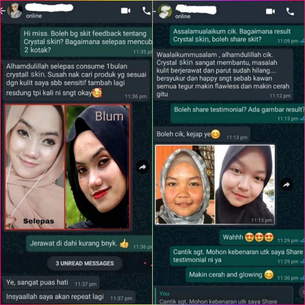 Rish beauty, Crystal Skin, Produk Kecantikan, Perawatan Kulit, Skincare, Cantik Alami, Jerawat, Jejaka, Wanita, Beauty by Rawlins, Rawlins GLAM, Rawlins Lifestyle