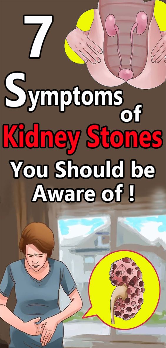 7 Symptoms Of Kidney Stones You Should Be Aware Of