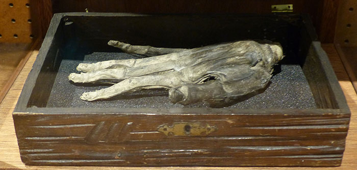 Hand of Glory