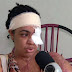 "Não sei como um ser humano pode ser tão perverso", desabafa mulher ataca com ácido por amante do marido
