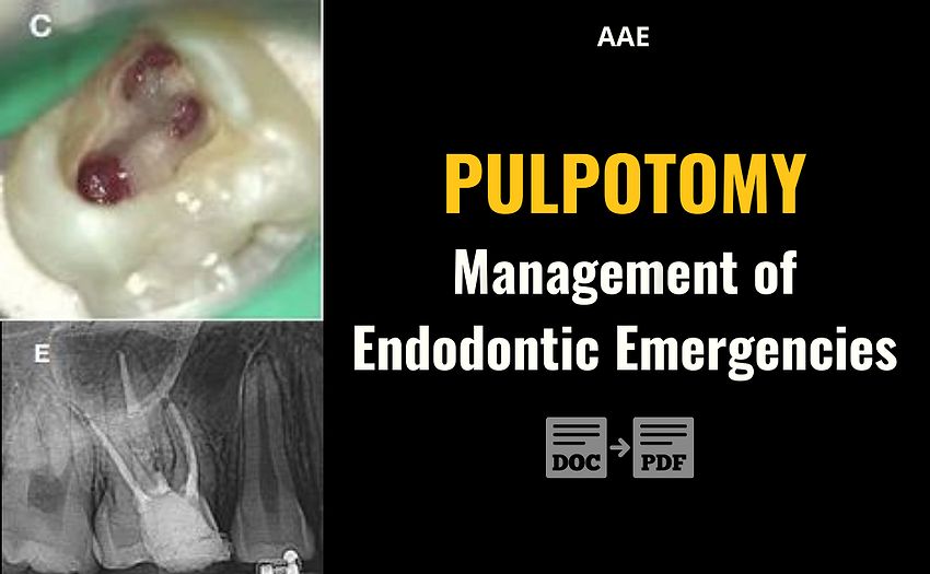 PDF Pulpotomy Management of Endodontic Emergencies AAE