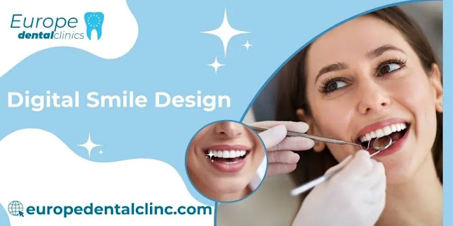 Digital Smile Design - Europe Dental Clinic