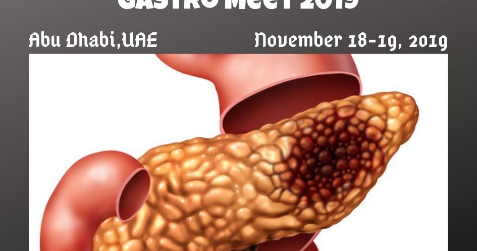 Advances in pancreatic cancer treatment