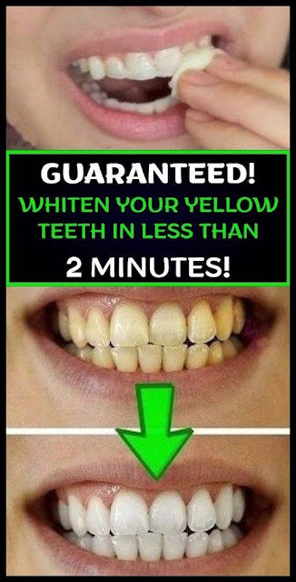 Whiten Your Yellow Teeth In Less Than 2 Minutes! GUARANTEED!