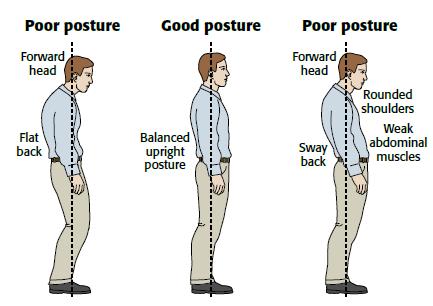 types of postures
