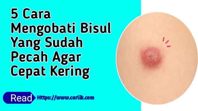 cara mengobati bisul yang sudah pecah agar cepat kering cara mengobati bisul yang sudah pecah agar cepat kering