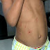 Mãe que agredia filho é espancada por vizinhas em condomínio