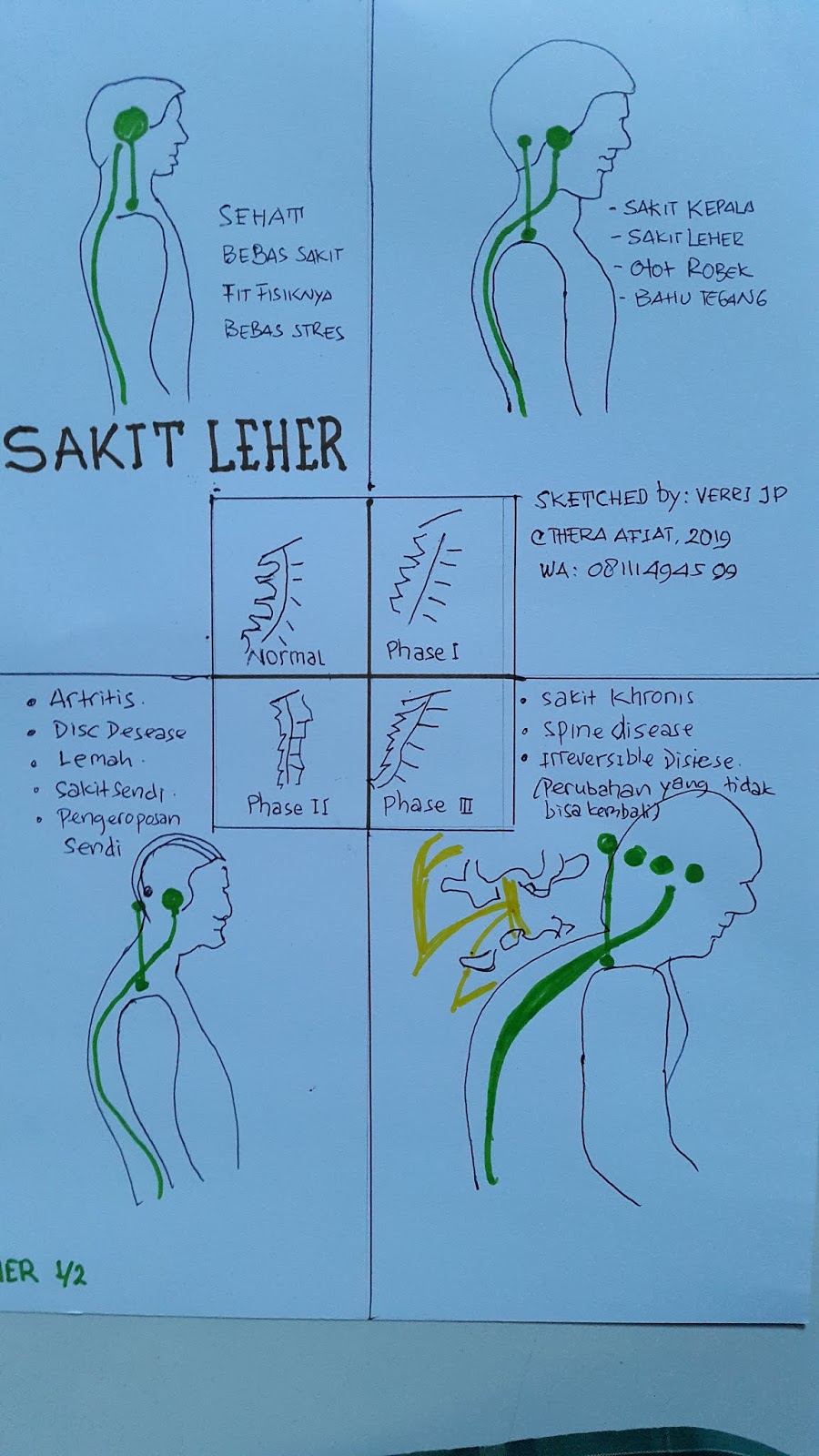 Tips Mengatasi Ketegangan Leher Saat Renang