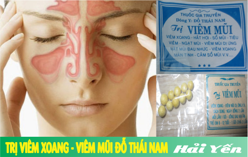 THUỐC VIÊM XOANG