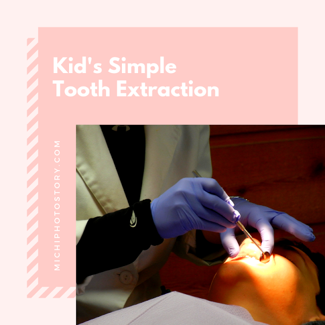 Michi Photostory Kid’s Simple Tooth Extraction