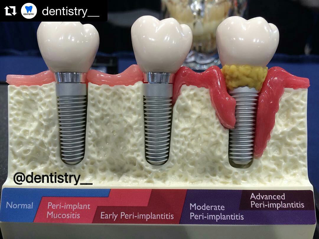 Britten Periodontics & Implant Dentistry Clearwater FL Periodontist