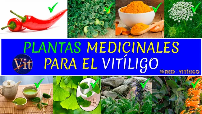Plantas Medicinales Para el Vitiligo - Medicina Natural Para Eliminar Manchas Blancas