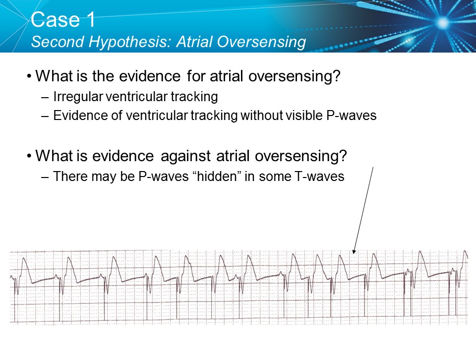 CVT Mohd Farid: Basic Pacemaker Troubleshooting Part I-Medtronic Academy