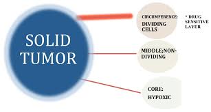 How To Treat Solid Tumor: The Ultimate Guide.