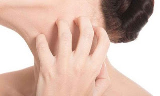 Bệnh mề đay mẩn ngứa