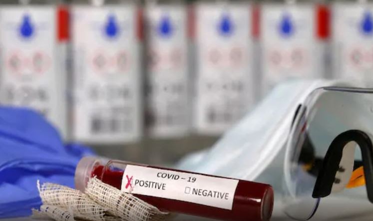 2021: Blogging A-Z Challenge: Covid Craziness: Y