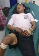 Korban kecelakaan di Batubara. Korban kecelakaan di Batubara.