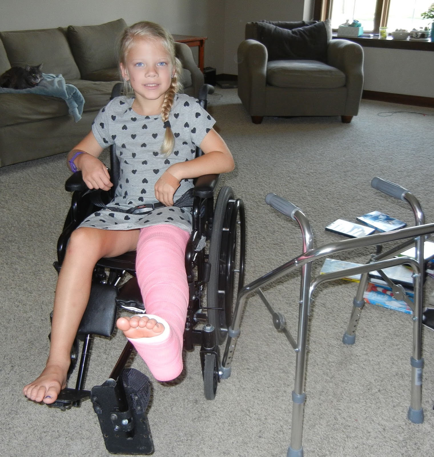 Miss Wheelchair With Leg Cast
