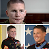 Medal Of Honor recipient Kyle Carpenter before and after facial reconstruction surgery. (Picture)