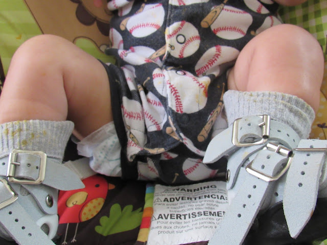 Clubfoot Baby Essentials BNB Stage | Writing Mother Fashionista