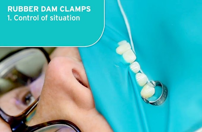 DENTAL INSTRUMENTS: Rubber Dam Clamps - Hu-Friedy - Dr. David Rice