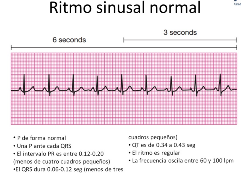 Tutoria Urgencias y Emergencias Bienvenidos a este blog sobre electrocardiografía básica. Tutoria Urgencias y Emergencias Bienvenidos a este blog sobre electrocardiografía básica.