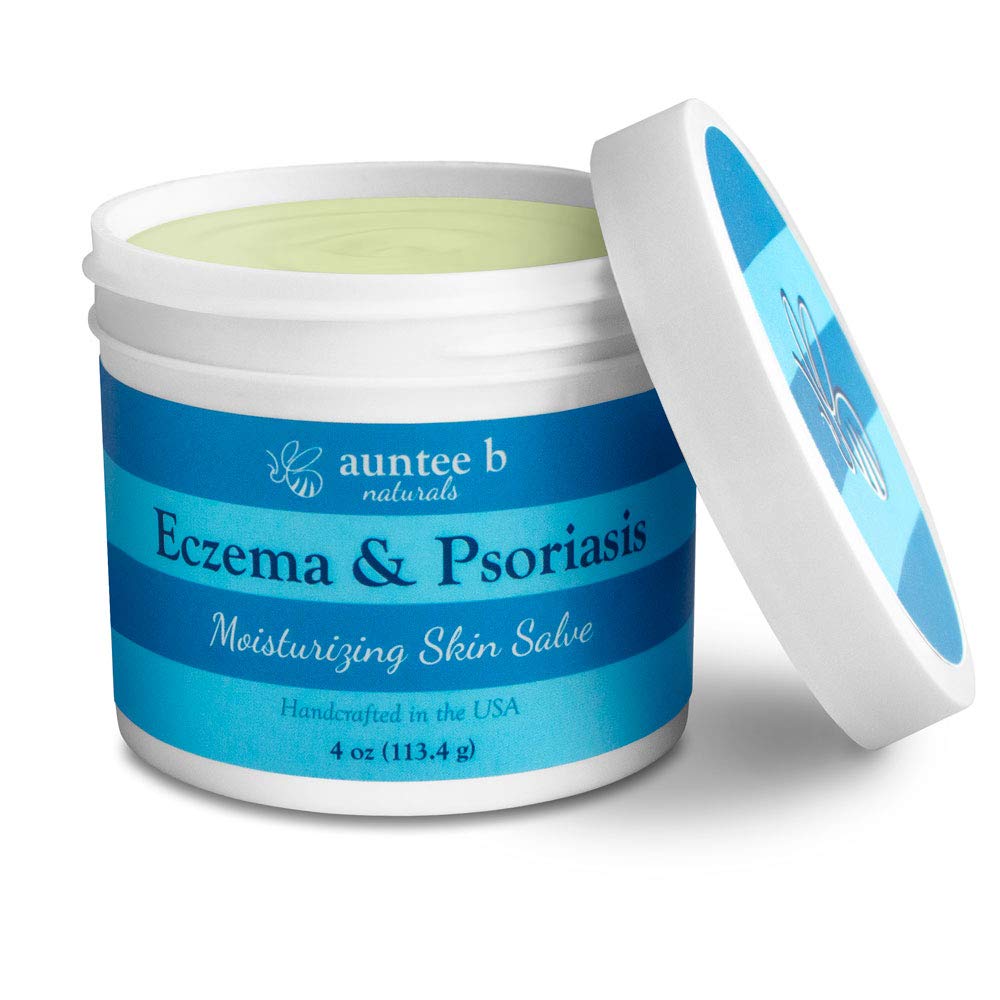 Natural Eczema and Psorisasis Cream