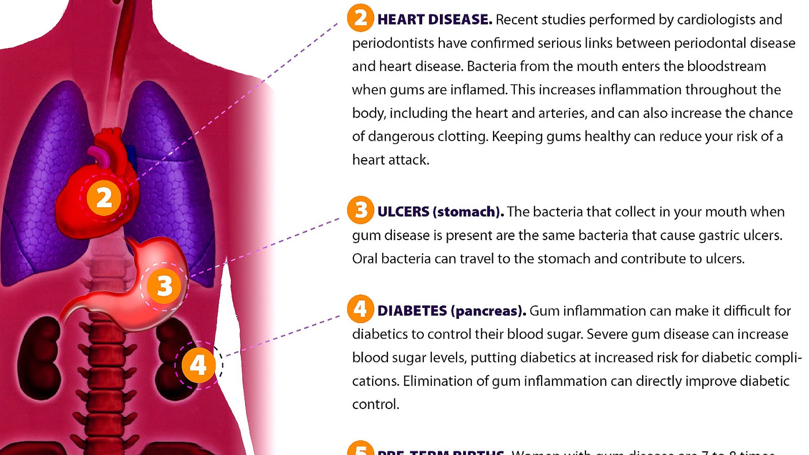Does Gum Disease Cause Heart Disease Hear Choices
