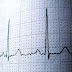 Right Ventricular Conduction Delay Meaning, Symptoms, Causes, Treatment
