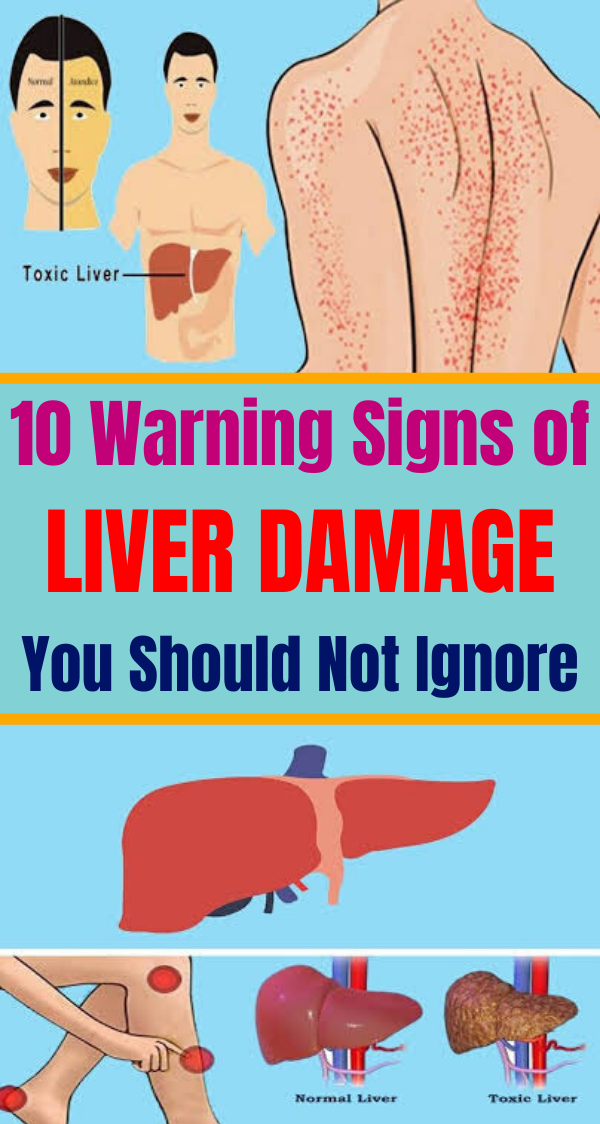 10 Warning Signals of Liver Damage You Should Not Ignore Holistic And
