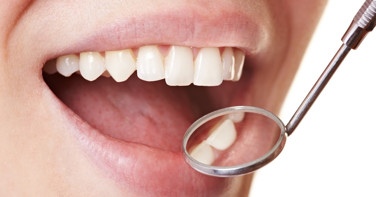 DENTAB ¿Qué es la placa dental?