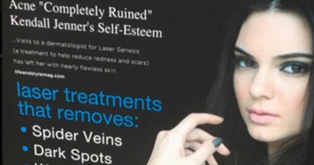 Kendall Jenner Sues Skincare Company For $10M For Using Her Face