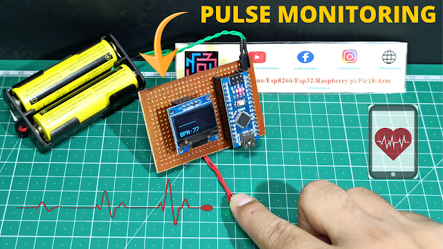 Arduino Based ECG Display Using Pulse Sensor
