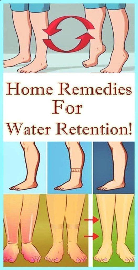 12 Simple Remedies To Avoid Water Retention In Your Body