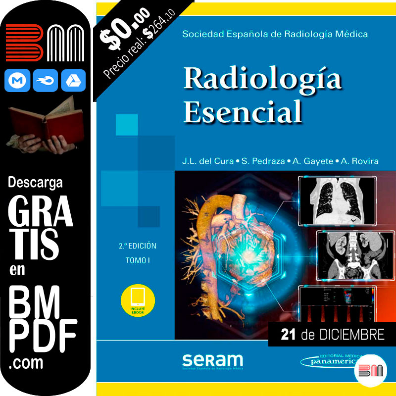 Radiología Esencial 2da edición TOMO 1 PDF