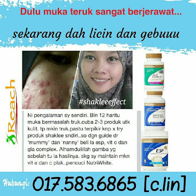 set kecantikan shaklee