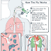 Upper Respiratory Tract Infections( common cold)
