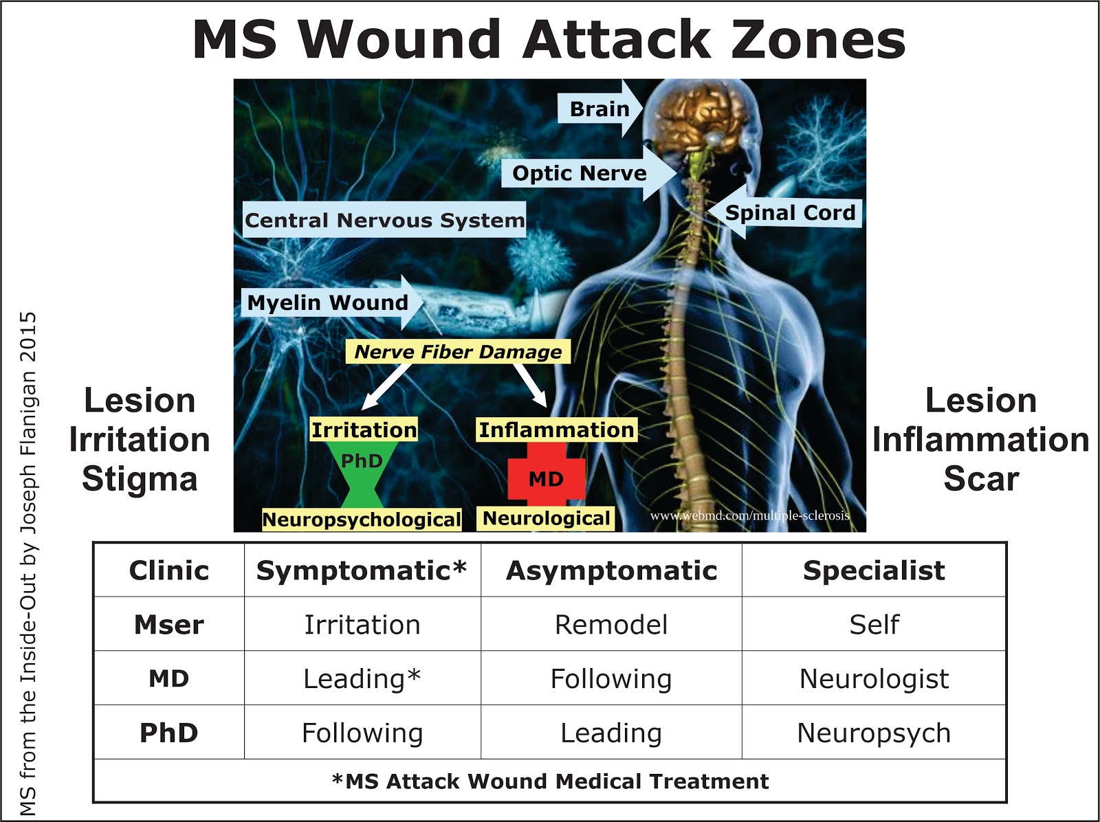 A Man And His Ideas Multiple Sclerosis MS Attack Zones
