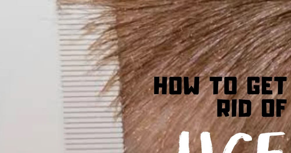 How To Get Rid Of Lice Overnight?