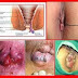Kapsul Ambejos thumbnail