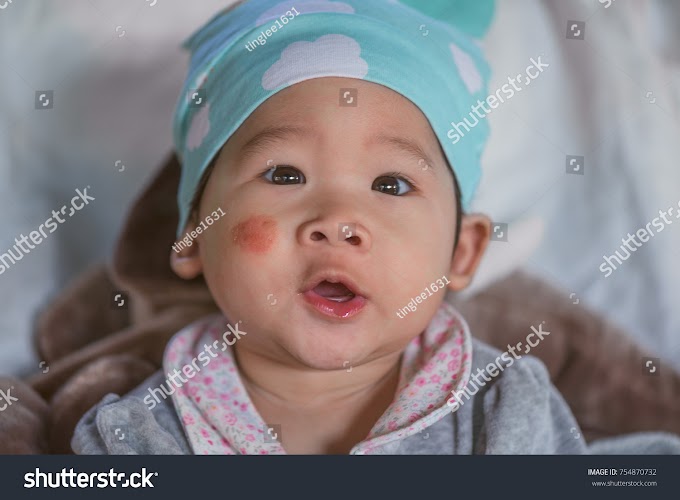 IS WHITE SPOTS ON CHILDREN’S FACE DANGEROUS?