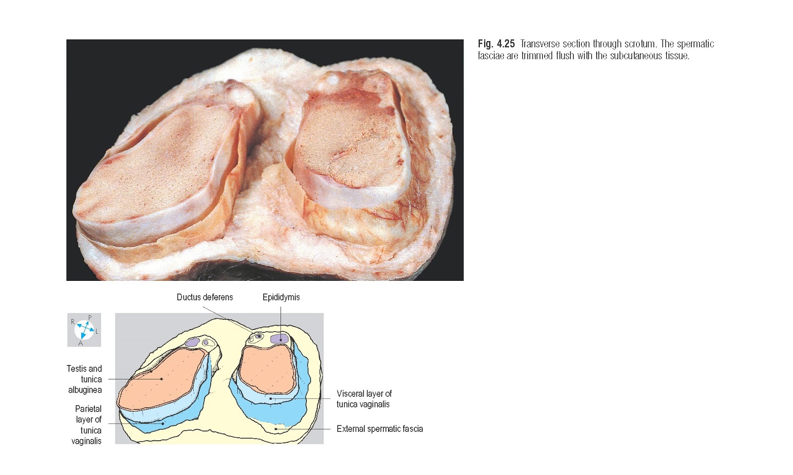 Scrotum Anatomy pediagenosis