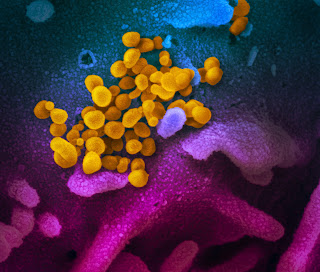 İnsan hücresinden çıkan SARS-CoV-2 (sarı)